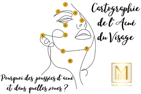 Cartographie de l'Acné du Visage VS Masque de Luminothérapie